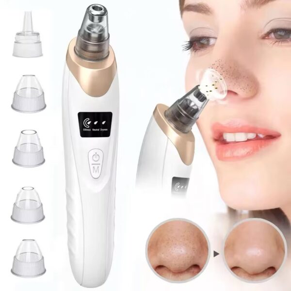 Blackhead Acne remover